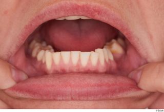 Arina Shy teeth 0003.jpg